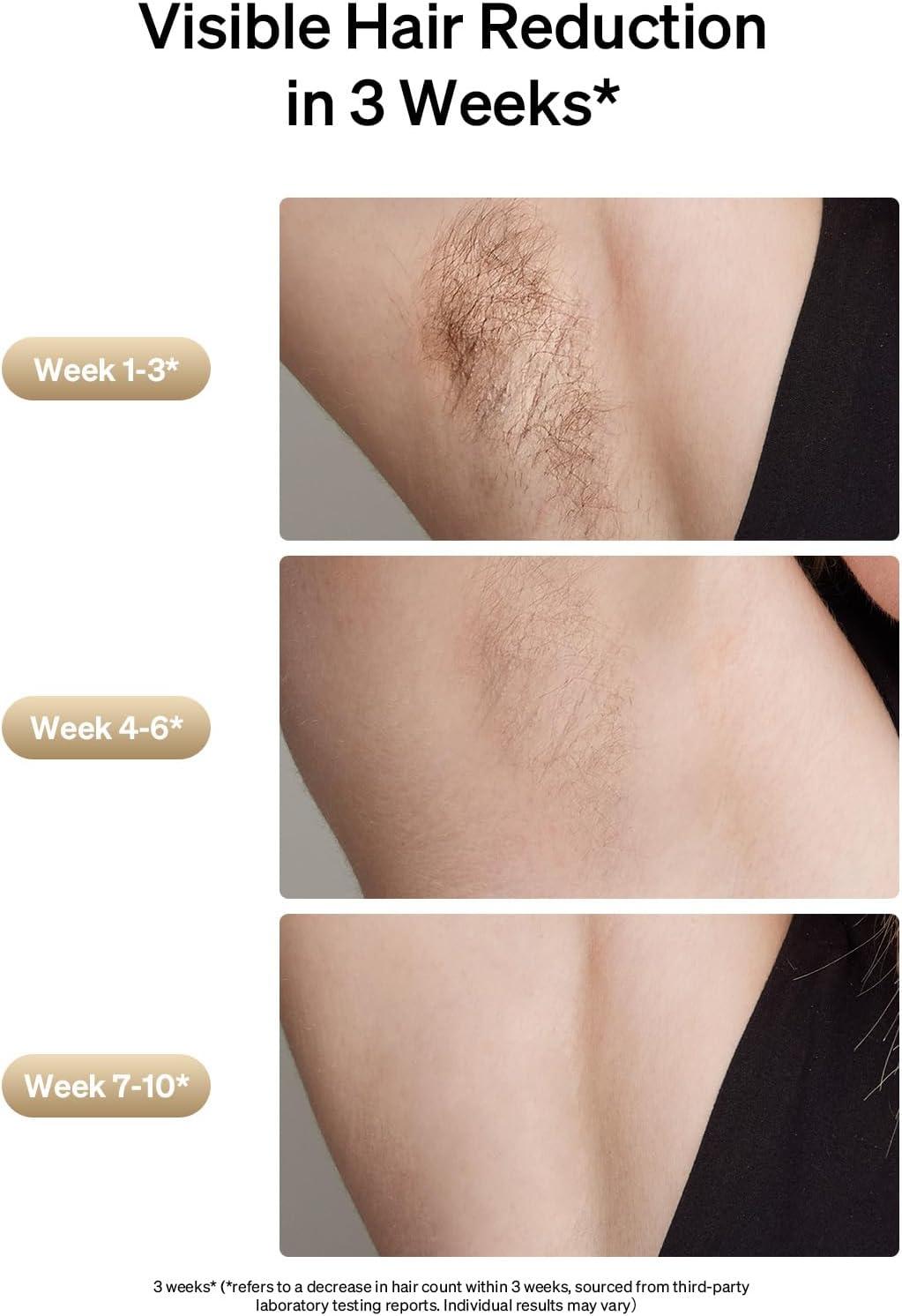 image:imageUlike Laser Hair Removal Air 3 IPL Hair Removal with Gift Set Sapphire IceCooling for Nearly Painless Treatment amp LongLasting Hair Removal Results Safe for Whole Body Use