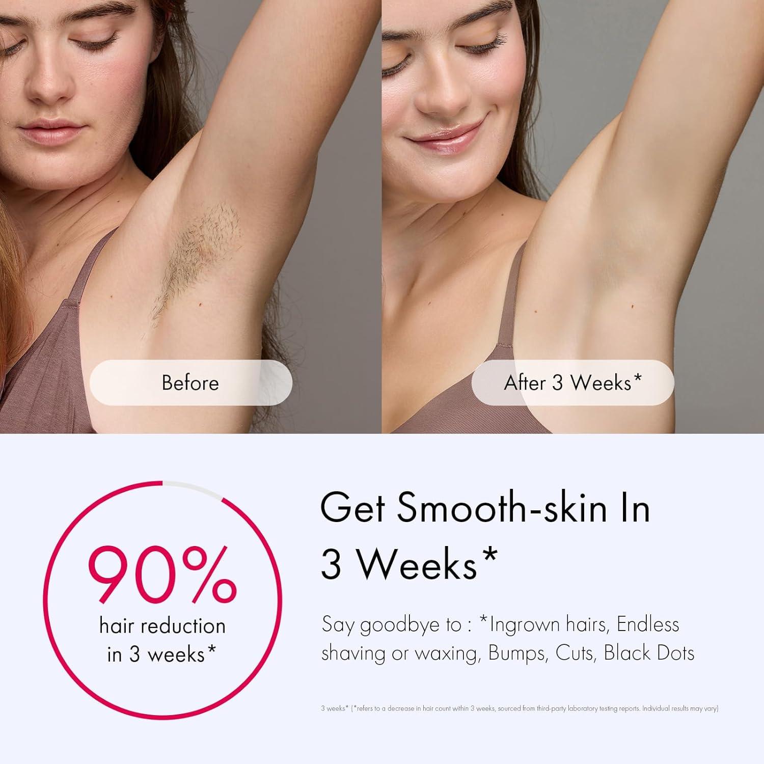 image:imageUlike Laser Hair Removal for Women and Men Air 3 IceCooling IPL Device Hair Removal for Nearly Painless amp LongLasting Results 3 Modes amp Auto Flashing for Fast Full Body Hair Removal from HomePurple