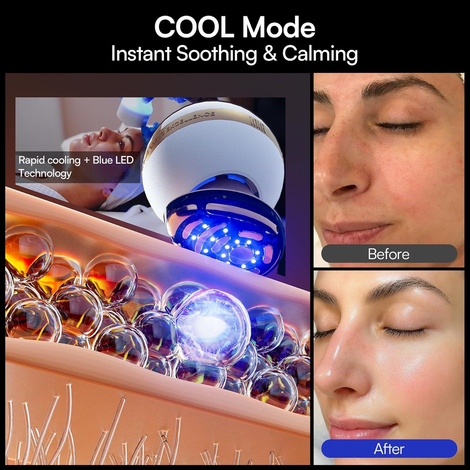 image:imageINIA SPHERA Upgraded 8in1 Microcurrent Facial Device for Face amp Neck Red Light Thermal amp Cooling Beauty Tool 5 Custom Modes atHome Skin Stimulation amp Glow Care Skincare Tool