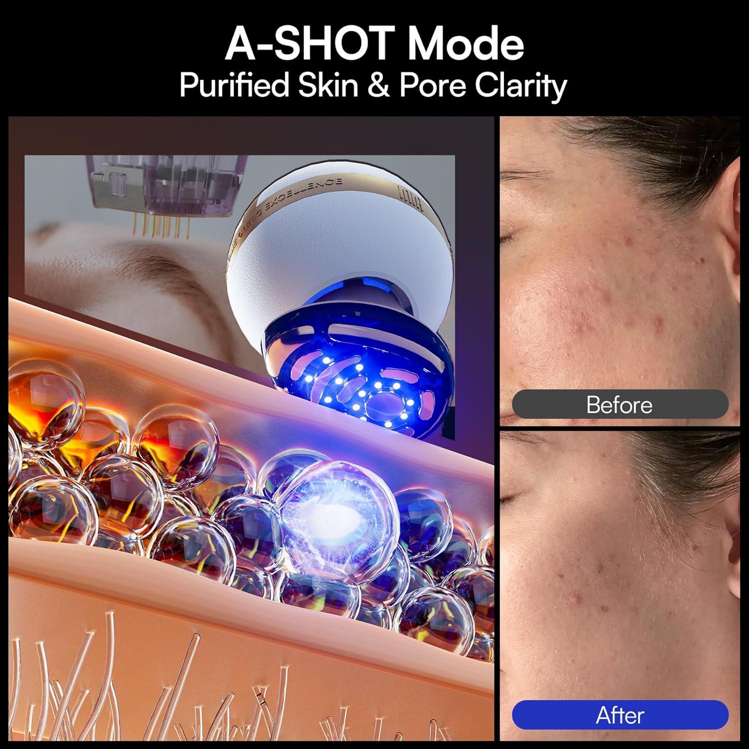 image:imageINIA SPHERA Upgraded 8in1 Microcurrent Facial Device for Face amp Neck Red Light Thermal amp Cooling Beauty Tool 5 Custom Modes atHome Skin Stimulation amp Glow Care Skincare Tool