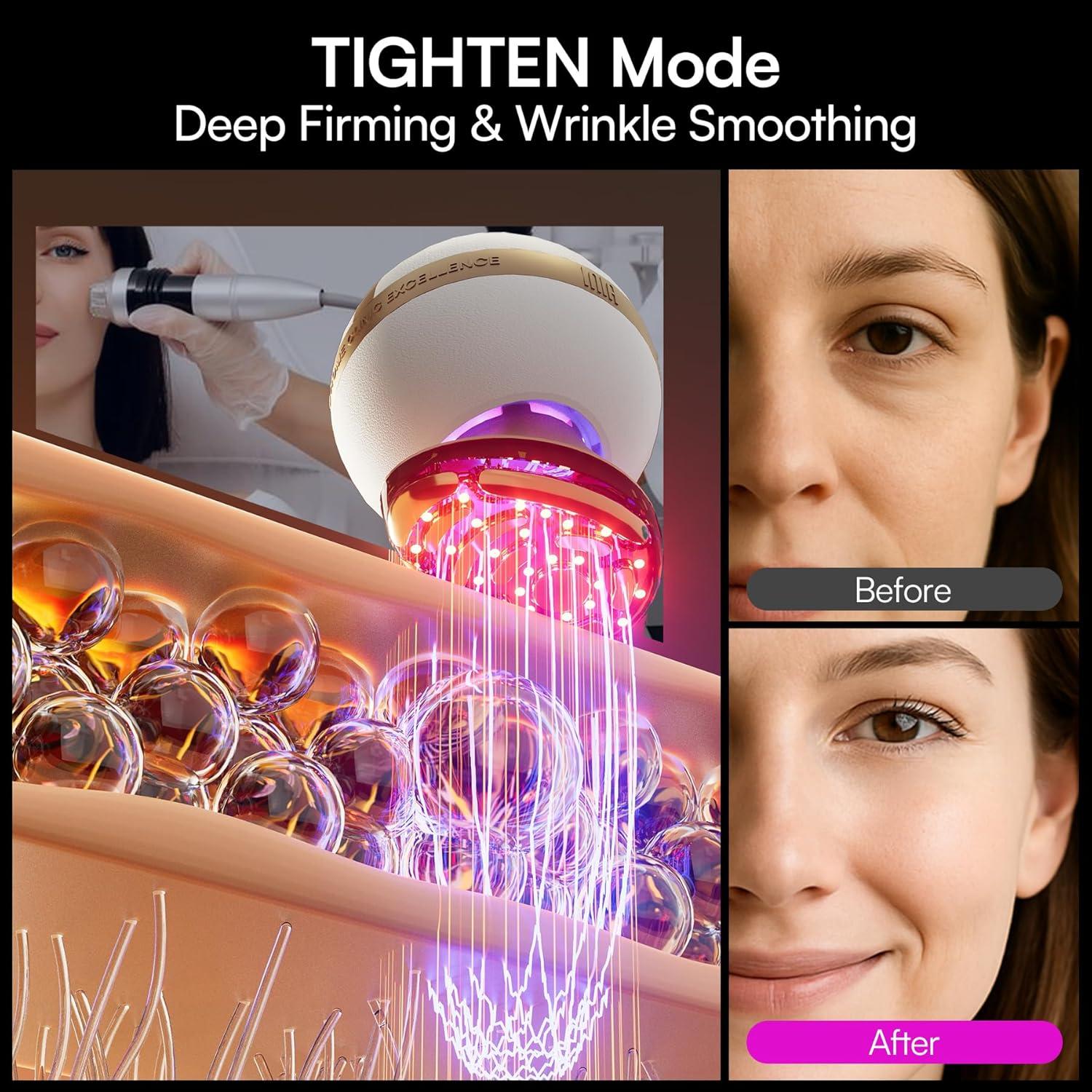 image:imageINIA SPHERA Upgraded 8in1 Microcurrent Facial Device for Face amp Neck Red Light Thermal amp Cooling Beauty Tool 5 Custom Modes atHome Skin Stimulation amp Glow Care Skincare Tool