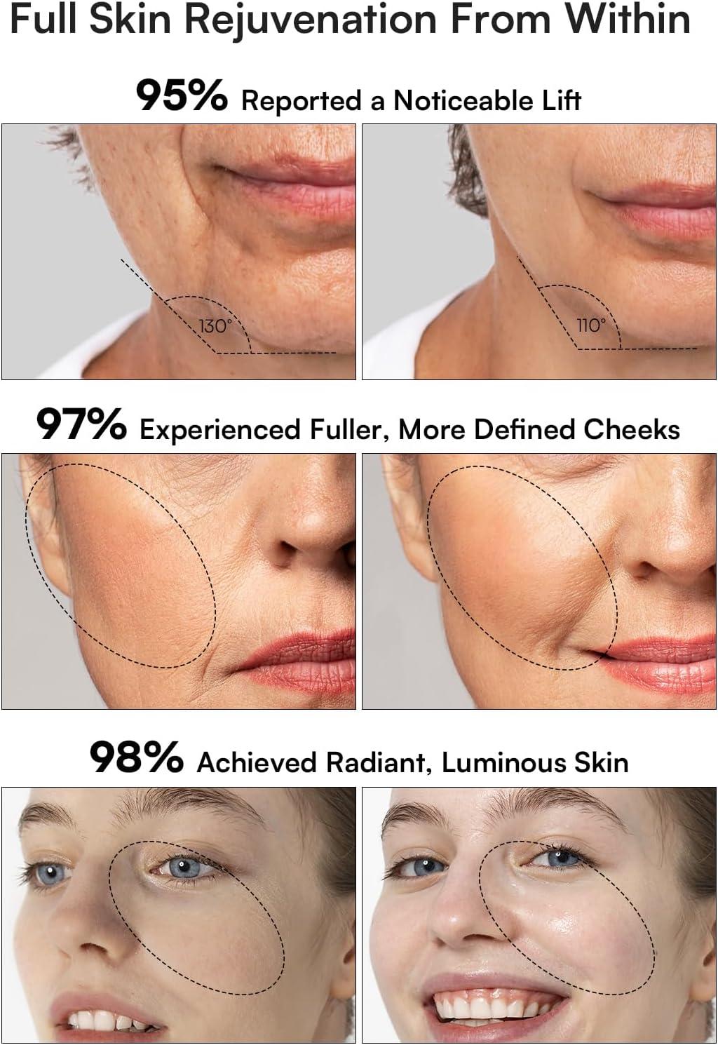 image:imageINIA 3in1 Skin Tightening Device True Beauty Glow Facial Massager Red Light Therapy for Face and Neck