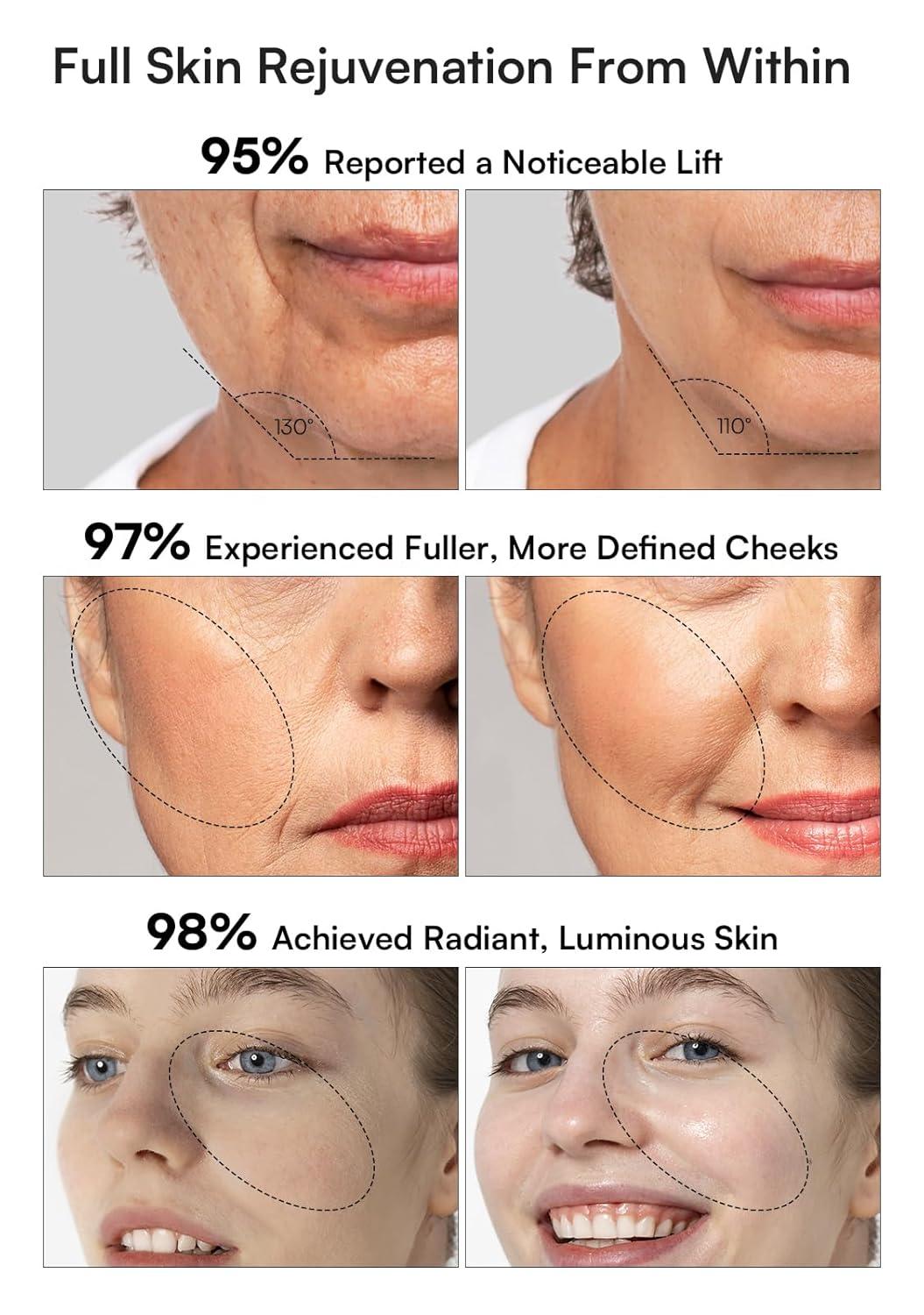 image:imageINIA 3in1 Skin Tightening Device True Beauty Glow Facial Massager Red Light Therapy for Face and NeckWhite