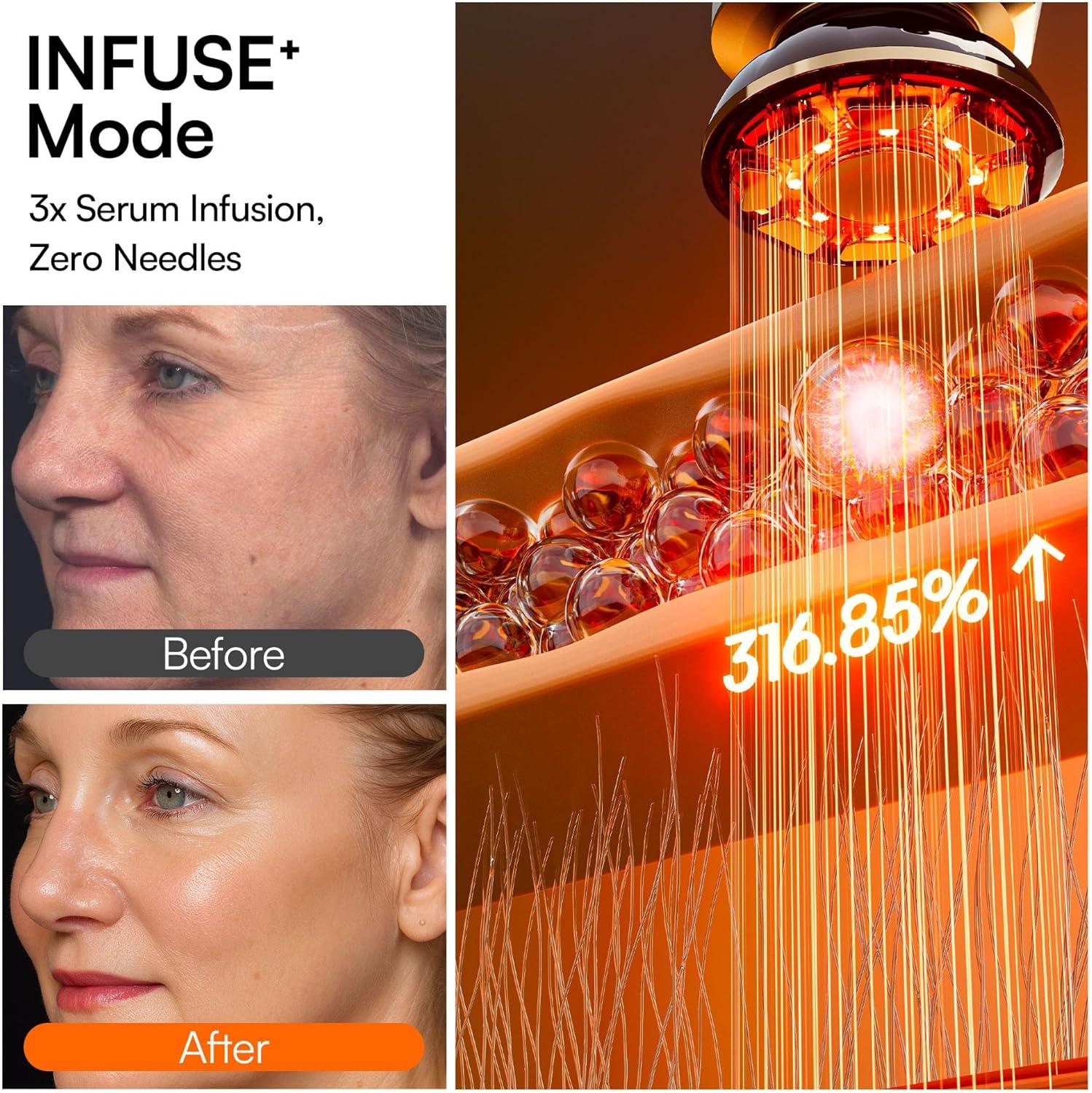 image:imageINIA Flare 3in1 Microcurrent Facial Device Red Light Therapy for Face and Neck Massager Tool with Heat amp Vibration for Skincare Puffiness Firming SmoothingRose Champagne